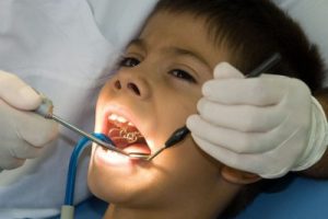 Cinco Ranch dental extractions
